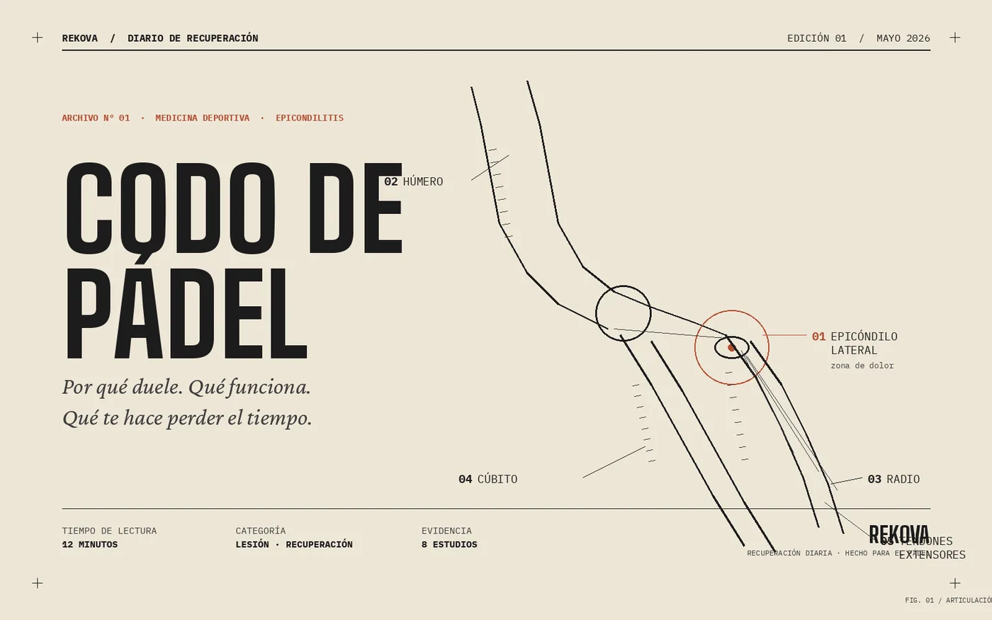 Codo de Pádel: Por Qué Duele, Qué Funciona y Qué te Hace Perder el Tiempo